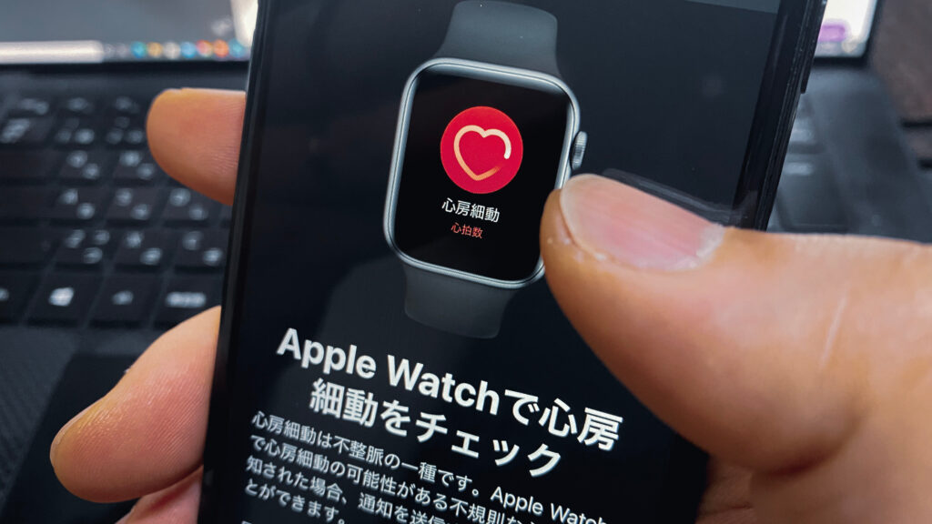 アップルウォッチ